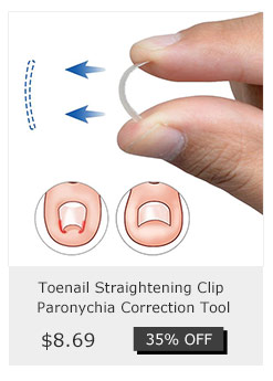 Toenail Straightening Clip Paronychia Correction Tool